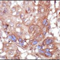 ACK1 Antibody
