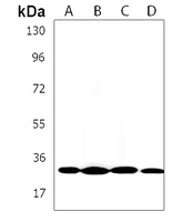 CABP1 Rabbit Polyclonal Antibody