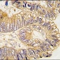 CLIC5 Antibody