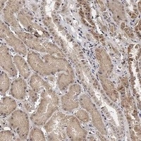 Anti-TECPR1 Antibody