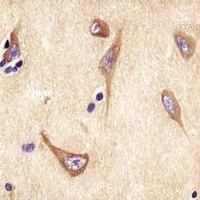 NP1 Rabbit Polyclonal Antibody