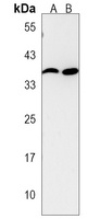 CaMK1 alpha Rabbit Polyclonal Antibody