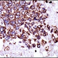 CaMK1 alpha Rabbit Polyclonal Antibody