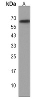 RIOK1 Rabbit Polyclonal Antibody