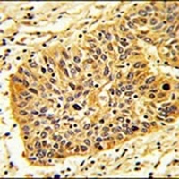 Anti-RIOK1 Antibody