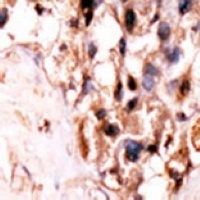 Anti-UCKL1 Antibody