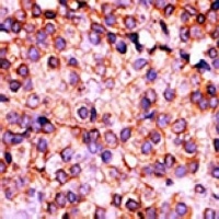 Anti-PANK3 Antibody