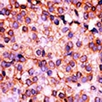 PANK3 Antibody