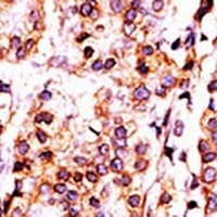 Anti-PANK1 Antibody