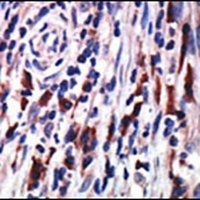 Anti-PKC eta Antibody