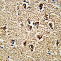 Anti-BICC1 Antibody