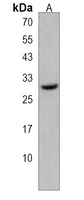 DIO1 Rabbit Polyclonal Antibody