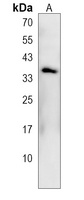 FOSB Rabbit Polyclonal Antibody