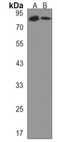 KSRP Rabbit Polyclonal Antibody