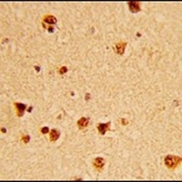 KSRP Rabbit Polyclonal Antibody