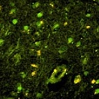KSRP Rabbit Polyclonal Antibody