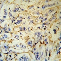 Anti-Fibrinogen alpha Antibody