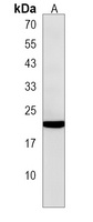 FKBP11 Rabbit Polyclonal Antibody