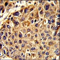 Anti-SPCS3 Antibody