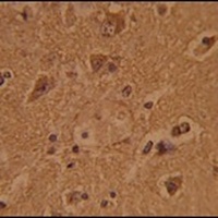 Anti-CTDP1 Antibody