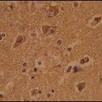 Anti-CTDP1 Antibody