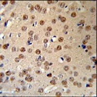 Anti-AMER1 Antibody