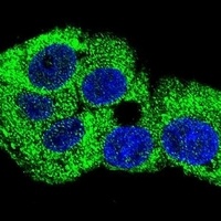 Anti-Gamma-Actin Antibody