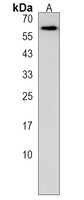 UGT2B17 Rabbit Polyclonal Antibody