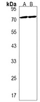 ZBTB7B Antibody