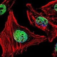 Anti-ZBTB7B Antibody