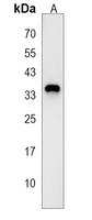 RCAN3 Antibody