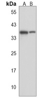 PARP16 Antibody