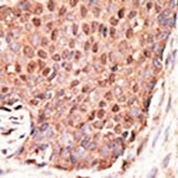 Anti-ZMIZ1 Antibody