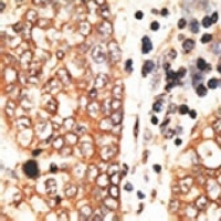 Anti-NRG2 Antibody