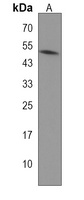 TRAM2 Rabbit Polyclonal Antibody