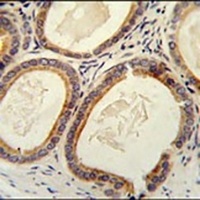 TRAM2 Rabbit Polyclonal Antibody