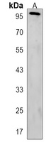 KIF9 Rabbit Polyclonal Antibody