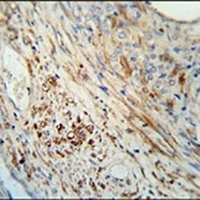 KIF9 Rabbit Polyclonal Antibody