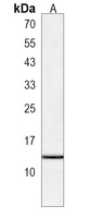 VKORC1 Rabbit Polyclonal Antibody