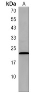 LOH12CR1 Rabbit Polyclonal Antibody