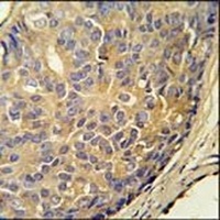 LOH12CR1 Rabbit Polyclonal Antibody