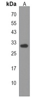 Aquaporin 11 Rabbit Polyclonal Antibody
