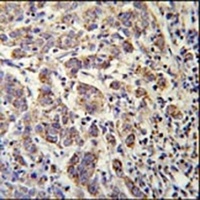 Anti-SOWAHC Antibody