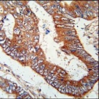 Anti-KLHL6 Antibody