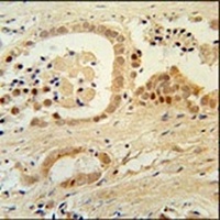 Anti-ZNF385B Antibody