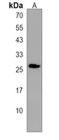RNF208 Rabbit Polyclonal Antibody
