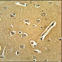 RNF208 Rabbit Polyclonal Antibody