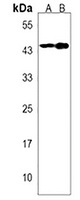 Calcitonin Receptor Rabbit Polyclonal Antibody