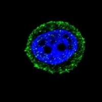 Anti-Calcitonin Receptor Antibody