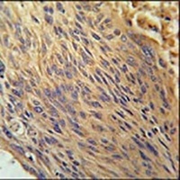 Anti-CPEB4 Antibody